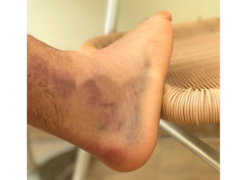 مچ سیاه شده امید و حسرت بازی در فینال باشکوه آسیا