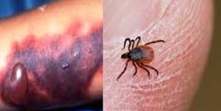 بیماری تب کریمه کنگو در مازندران گزارش نشد/ انجام سم‌پاشی در اماکن دامی