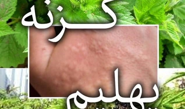 اندر فواید گیاهی پرخاصیت؛ از گزنه‌آش تا گزنه‌رُش!