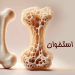 سنجش‌ تراکم استخوان، تشخیص طلایی