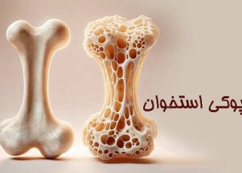 تحرک و ورزش، کلید پیشگیری از پوکی استخوان