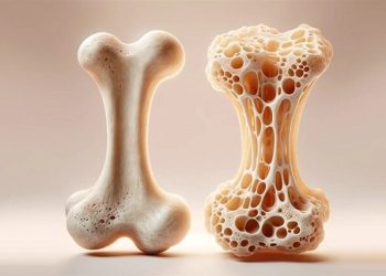 هر سقوط در سالمندان، هشدار شکستگی قریب‌الوقوع است