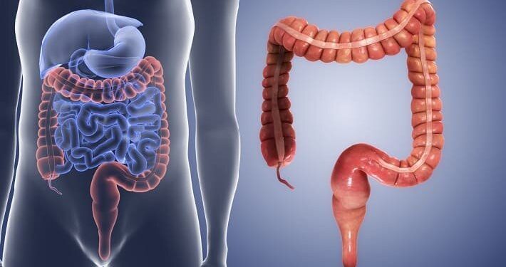 افزایش انسداد گوارشی ناشی از مصرف بی‌رویه «انار» و «خرمالو» در کودکان