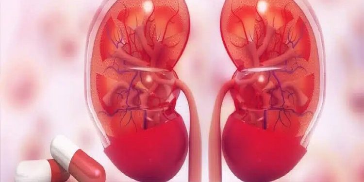 نفروپاتی دیابتی، عامل اصلی نارسایی کلیه/ کنترل قند و فشار خون کلید پیشگیری است