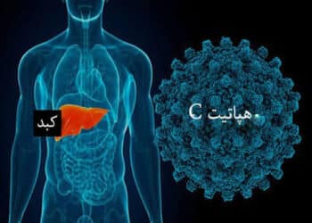 هپاتیت C بیماری خاموش بدون واکسن اما قابل درمان