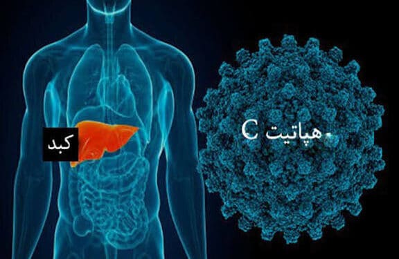 هپاتیت C بیماری خاموش بدون واکسن اما قابل درمان